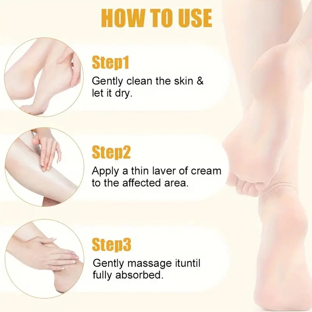 Urea 40% Foot Cream Intensive Moisturizer for Dry & Cracked Skin